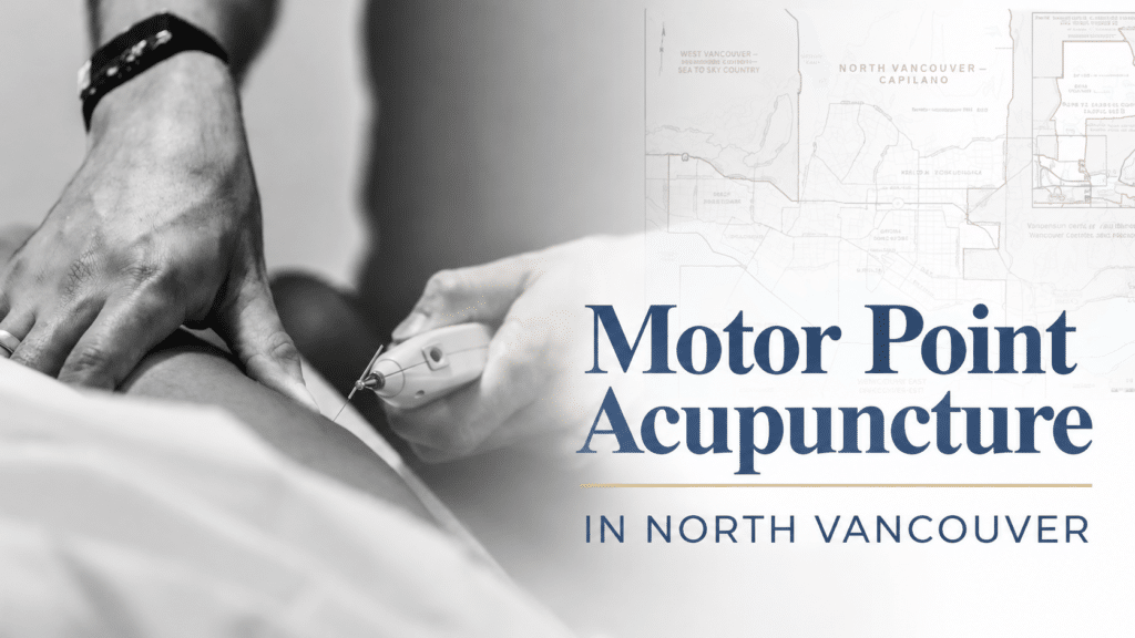 Motor Point Acupuncture